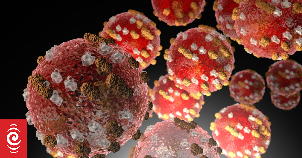 Measles outbreak: Two new cases in Northland, new locations of interest